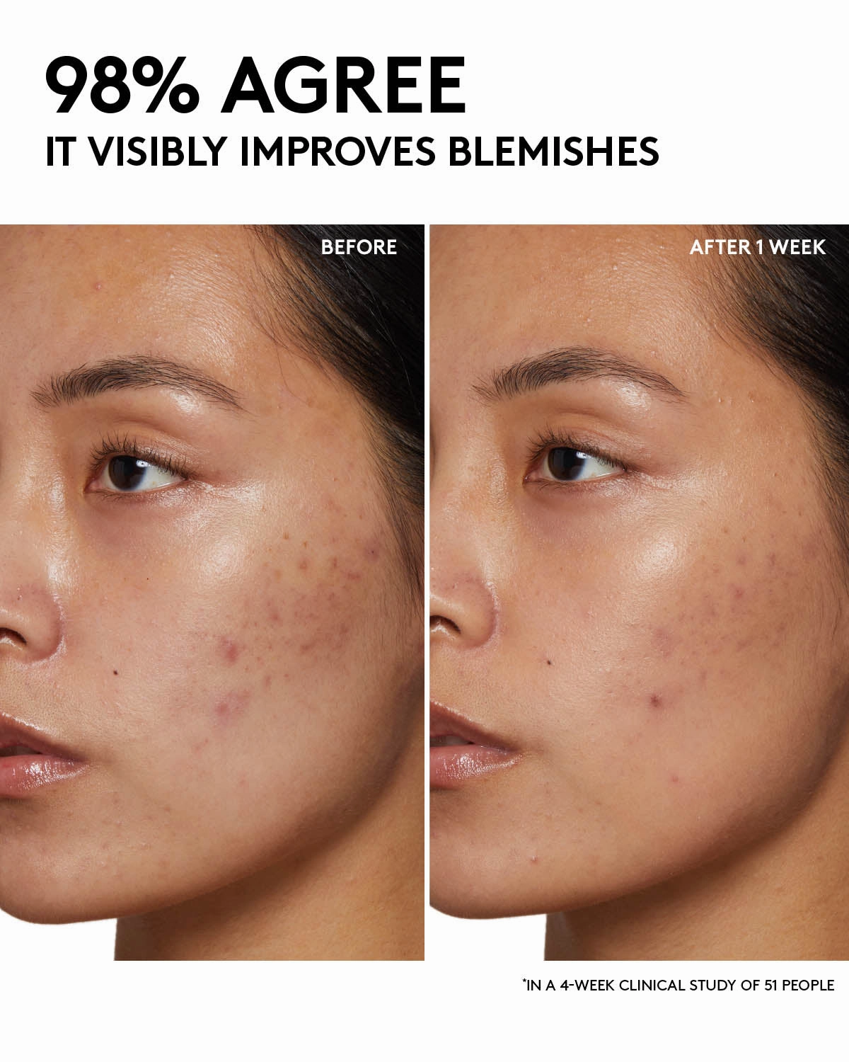 Fenty Skin Start’rs Full-Size Bundle with Mineral SPF: Oily Skin Edition