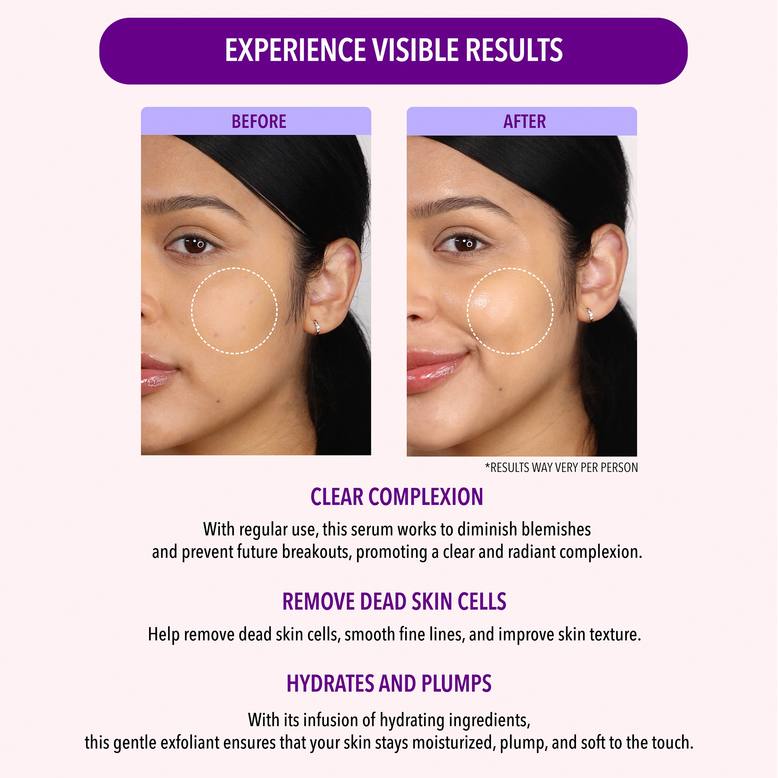 Oil Control Skincare Collection