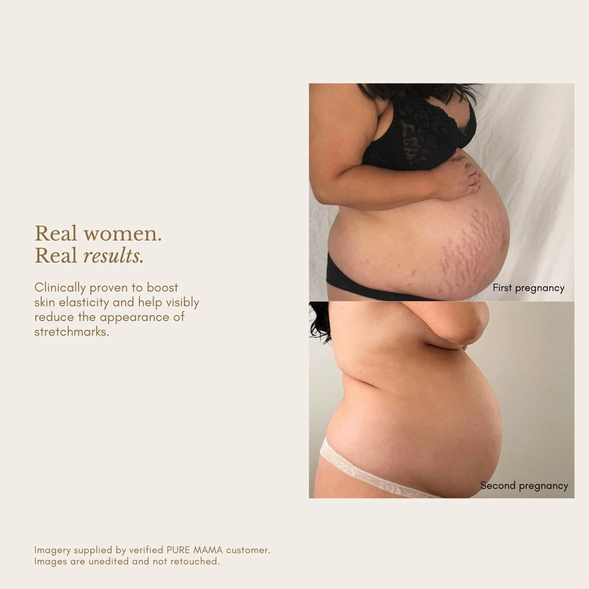 Stretch Mark Belly Oil